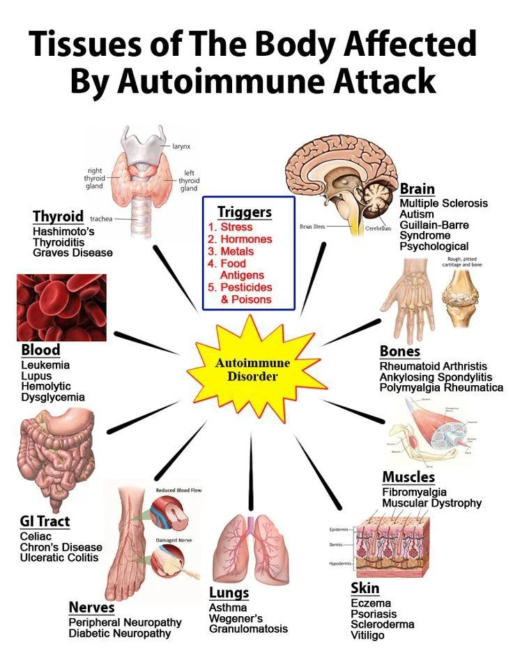 autoimmune diseases