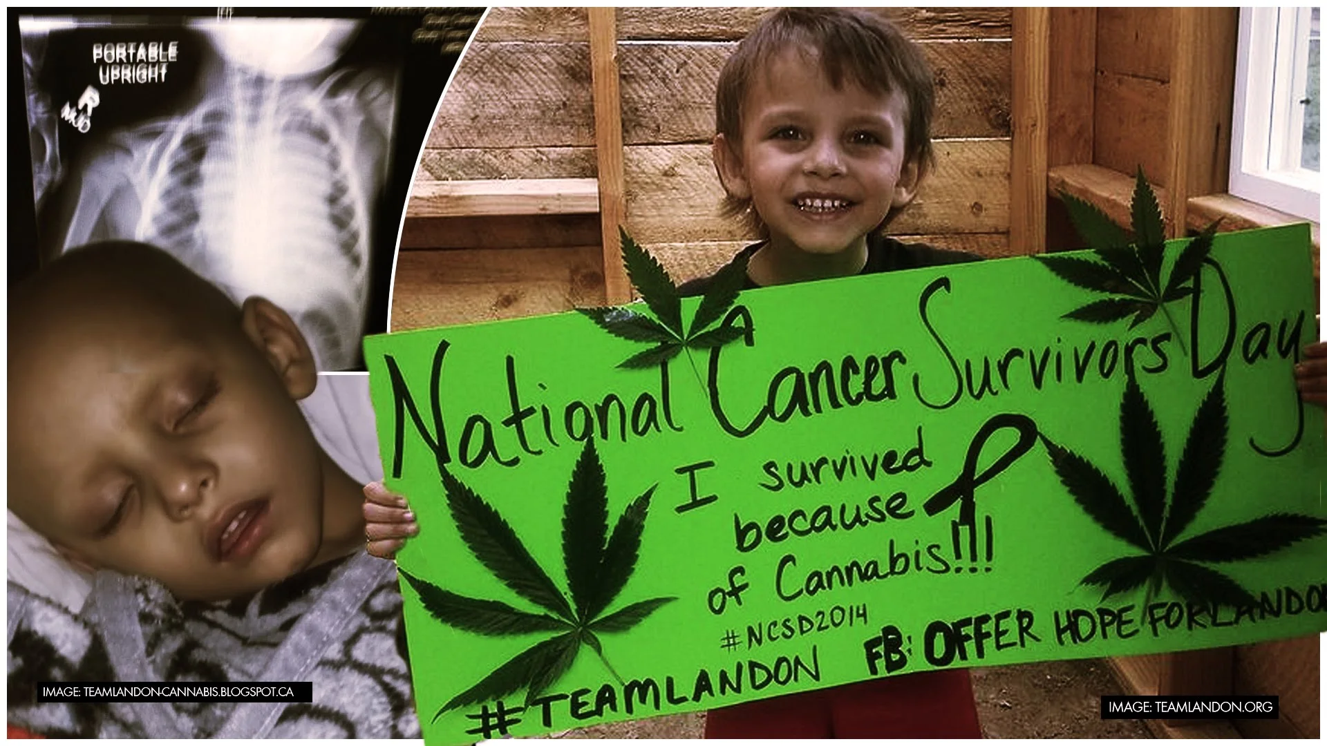 cancer